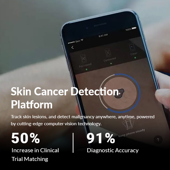 Computer Vision Services: Skin Cancer Detection