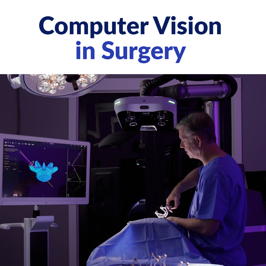 Computer vision in surgery