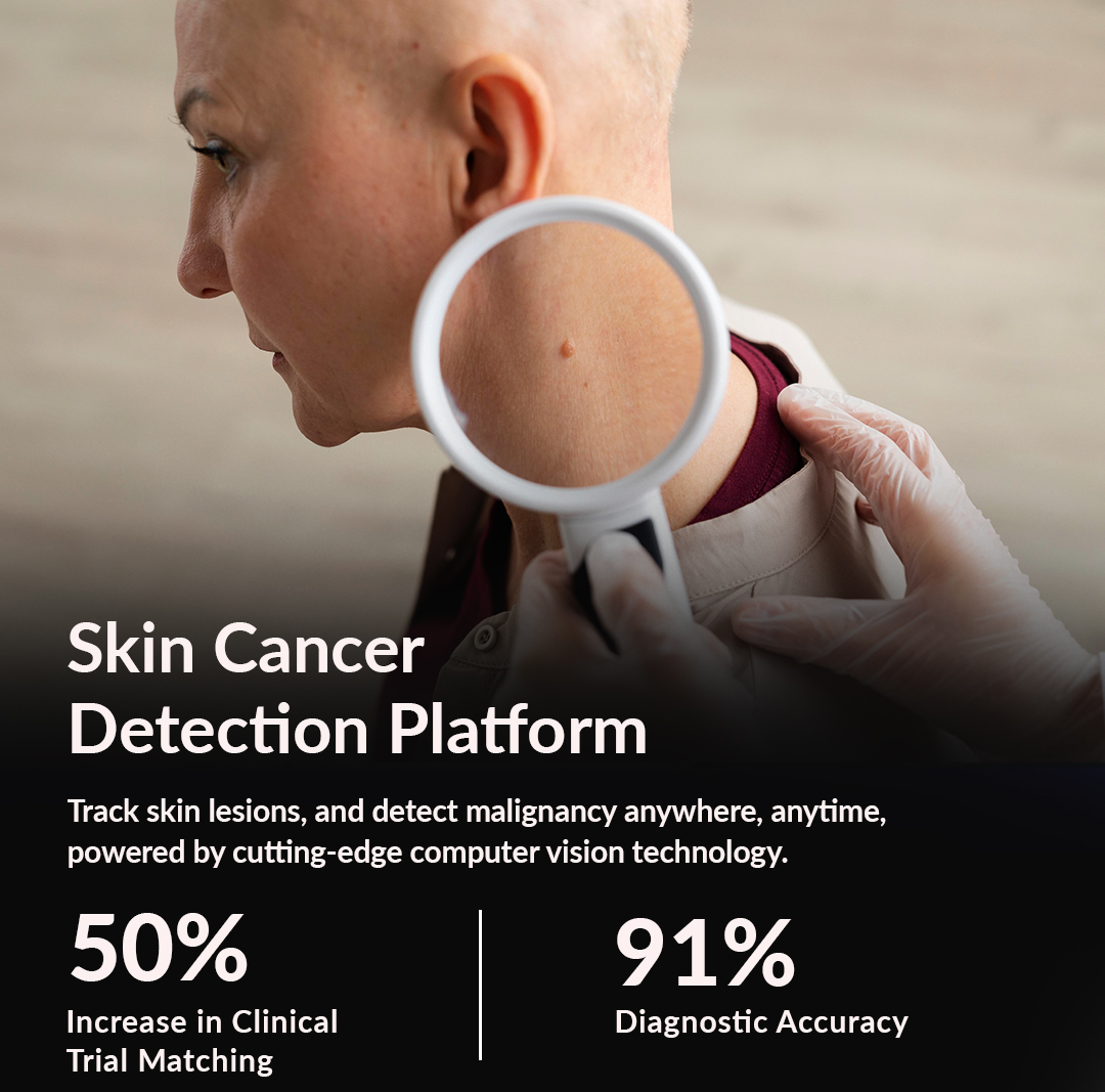 Skin Cancer Detection